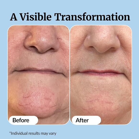 Super C Serum for Mature Skin - All-in-One Vitamin Formula Hydrates, Firms, Lift - Picture 5 of 8